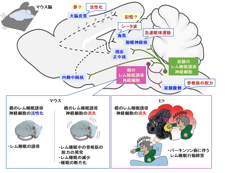 レム睡眠を誘導する神経回路を解明し「夢を演じる病」の原因を特定