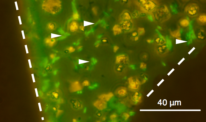 火星からのサンプルリターンで有効な微生物不活化技術の開発に成功